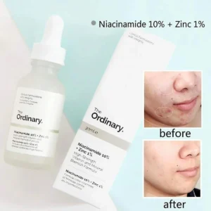 The Ordinary Niacinamide 10% + Zinc 1% Serum (30ml) – Oil Control & Blemish Care