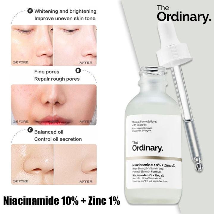 The Ordinary Niacinamide 10% + Zinc 1% Serum (30ml) – Oil Control & Blemish Care - Image 2